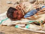 El brote de clera en Yemen es ya el mayor que se haya registrado en el mundo