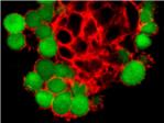 El CSIC emplea minigenes para rastrear la predisposicin al cncer de mama