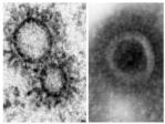 El virus de la gripe construye su propio orgnulo para transportar las molculas