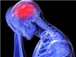 Investigan potenciales nuevas dianas teraputicas contra la migraa