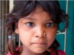 La lepra infantil aumenta en la India un 18%, pese a haberla declarado como eliminada en 2005