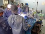 L'Hospital de la Ribera incorpora l'ltima tecnologia robtica per a l'implant de prtesi de genoll