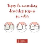 Tipus de taques dentals segons el seu color