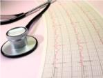 Un nuevo software mejorar la caracterizacin de arritmias cardiacas