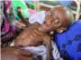 Unas 258.000 personas murieron de hambre en la sequa somal de 2011 y 2012