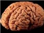 El cerebro humano, uno de los ms grandes enigmas