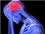 Investigan potenciales nuevas dianas teraputicas contra la migraa