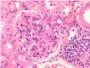 La desregulacin de una molcula facilita el desarrollo de enfermedades como el lupus