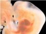 Las clulas de hgado fetal son aptas para crear injertos vasculares en neonatos y adultos