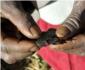 'Mdicos del Mundo' exige que el protocolo nacional contra la mutilacin genital femenina no caiga en saco roto