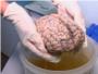 Un hospital psiquitrico belga recibe la mayor coleccin de cerebros del mundo