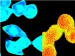 Un estudio descubre una alta entrada de calcio en las clulas de cncer colorrectal