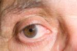 V Campaa de Prevencin de la Ceguera y Glaucoma en Algemes