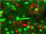 Los astrocitos ayudan a coordinar la actividad neuronal