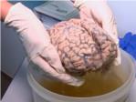Un hospital psiquiátrico belga recibe la mayor colección de cerebros del mundo