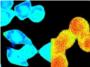 Un estudio descubre una alta entrada de calcio en las células de cáncer colorrectal