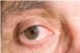 V Campaa de Prevencin de la Ceguera y Glaucoma en Algemes