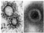 El virus de la gripe construye su propio orgnulo para transportar las molculas