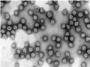Investigadores del CSIC demuestran que un fármaco contra el melanoma logra frenar un coronavirus humano