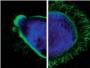 Una proteína generada por el virus del herpes potencia el crecimiento axonal de las neuronas